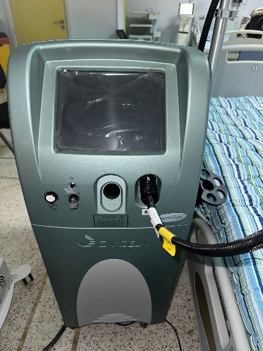 Laser pigmentaire 01