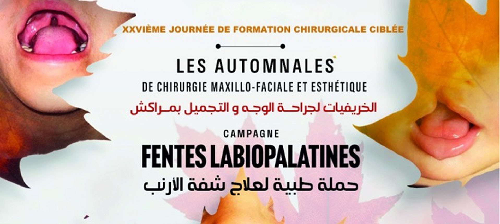 26ème édition des Automnales de Chirurgie Maxillo-Faciale et Esthétique