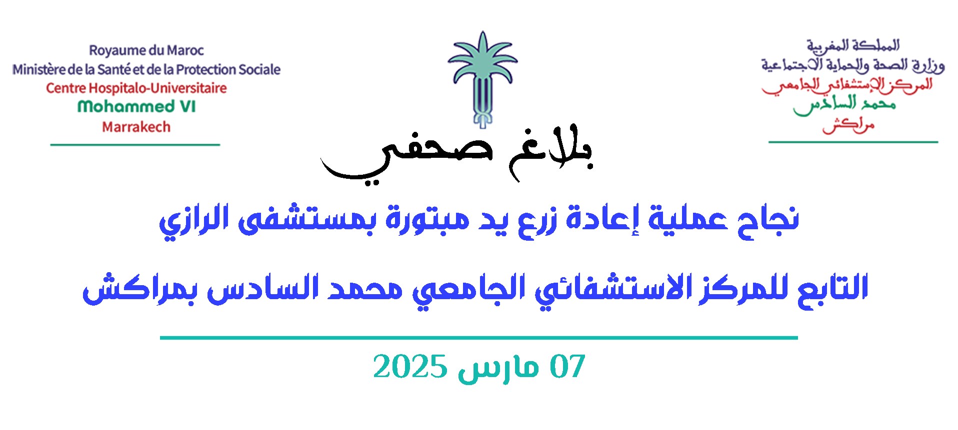 نجاح عملية إعادة زرع يد مبتورة بمستشفى الرازي  التابع للمركز الاستشفائي الجامعي محمد السادس بمراكش